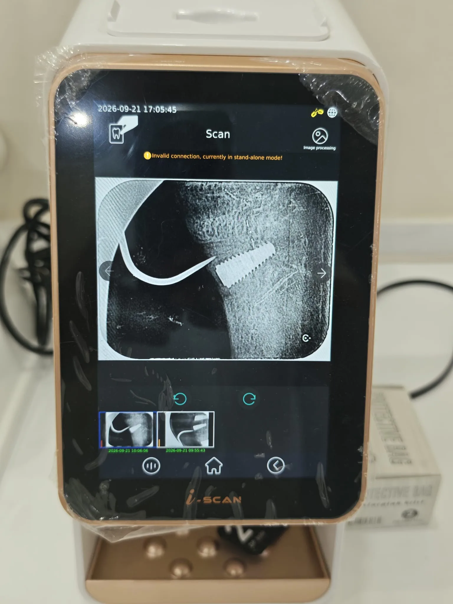 3D-Röntgen und digitale Scan-Diagnostik vor der Zahnbehandlung